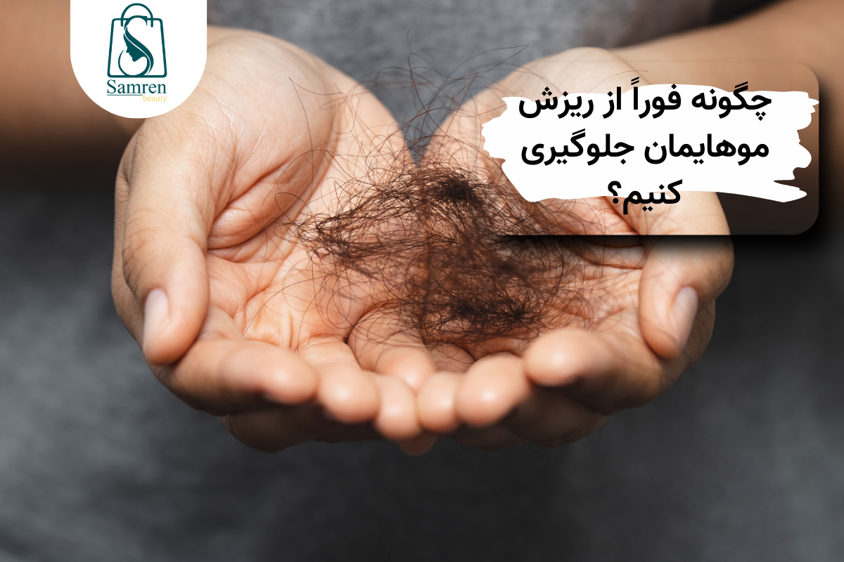 گونه فورا از ریزش مو های خود جلوگیری کنیم ؟