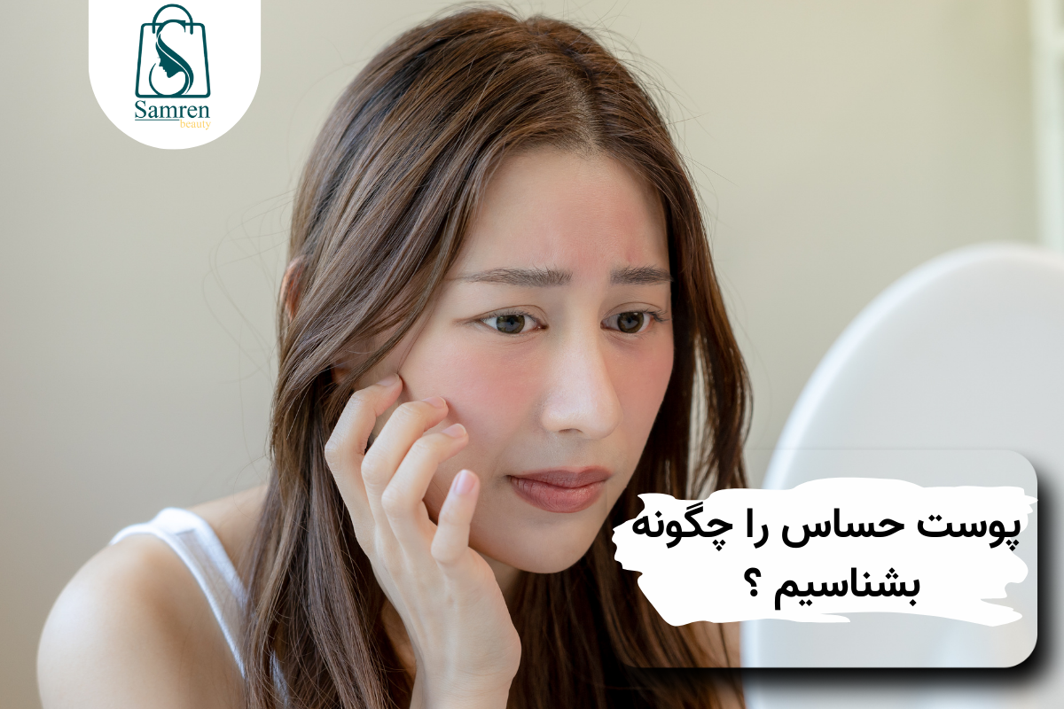 چگونه پوست حساس خود را بشناسیم ؟