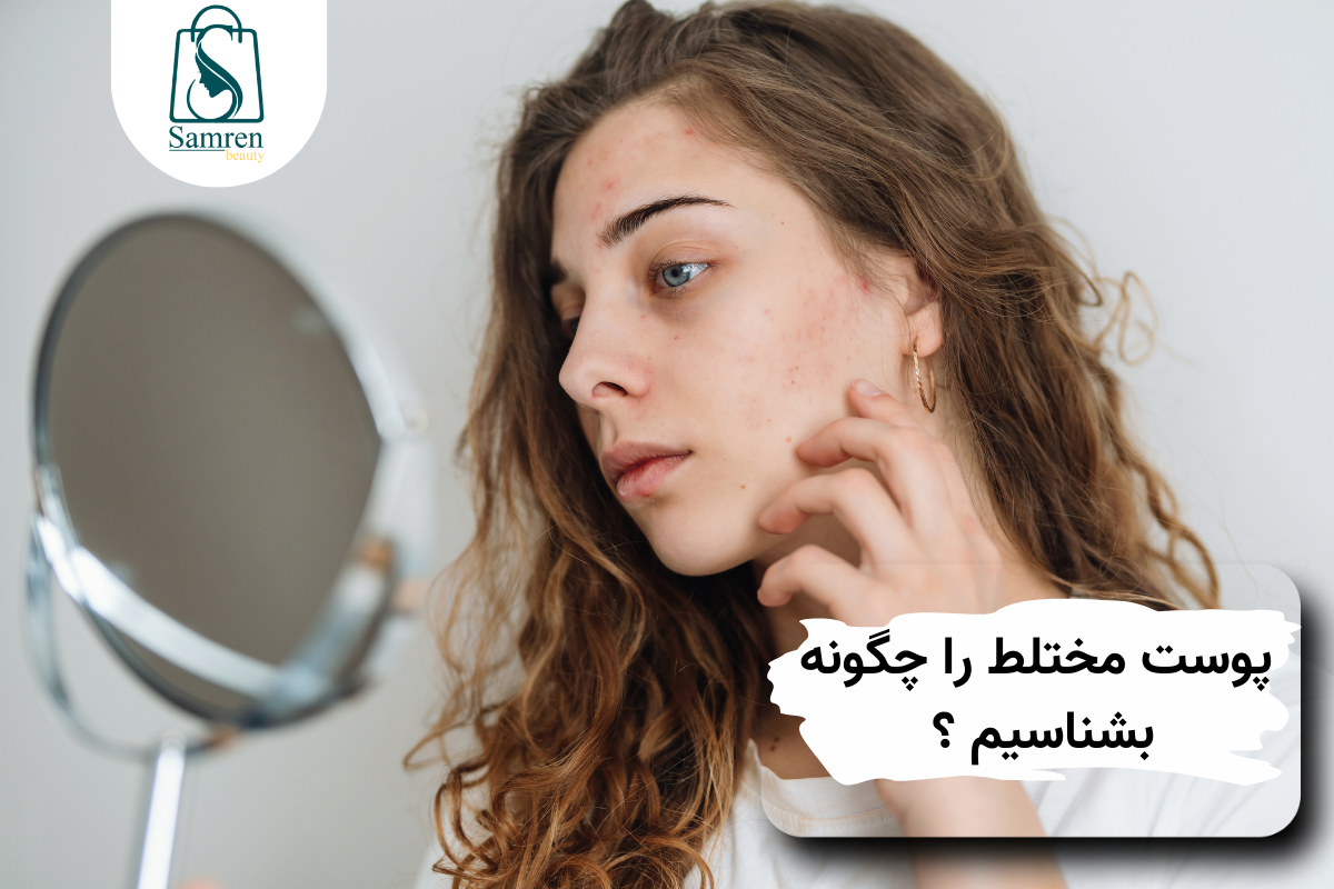 پوست مختلط خود را چگونه بشناسیم ؟