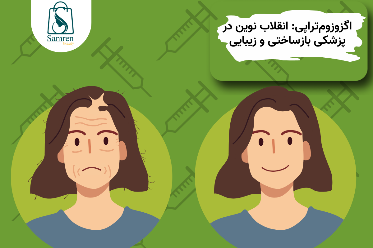 از پوست چرب 9